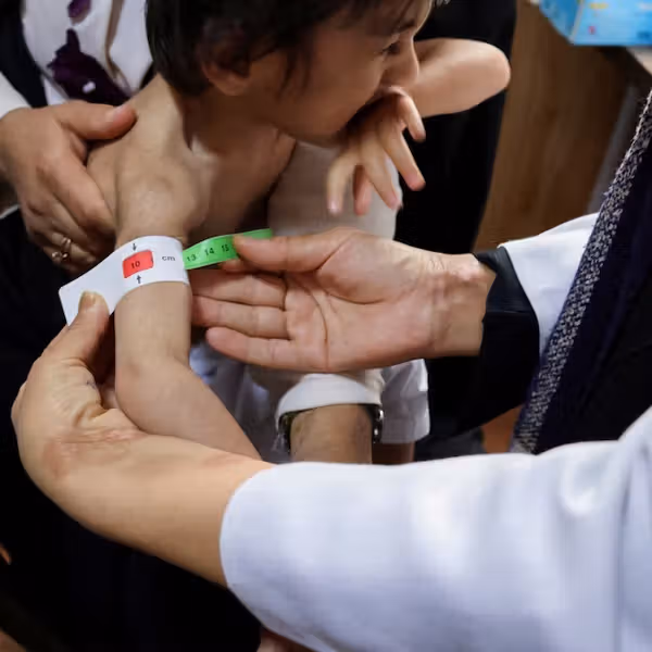 برنامه جهانی غذا میگوید سوءتغذیه مادران و کودکان در افغانستان افزایش یافته است