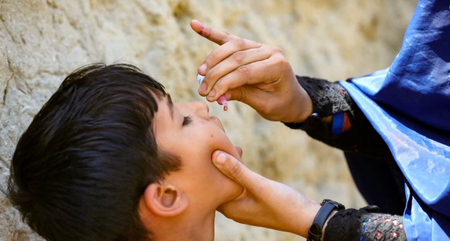 په تېرو ۱۲ میاشتو کې په کابل کې د پولیو دوه مثبتې پېښې ثبت شوې