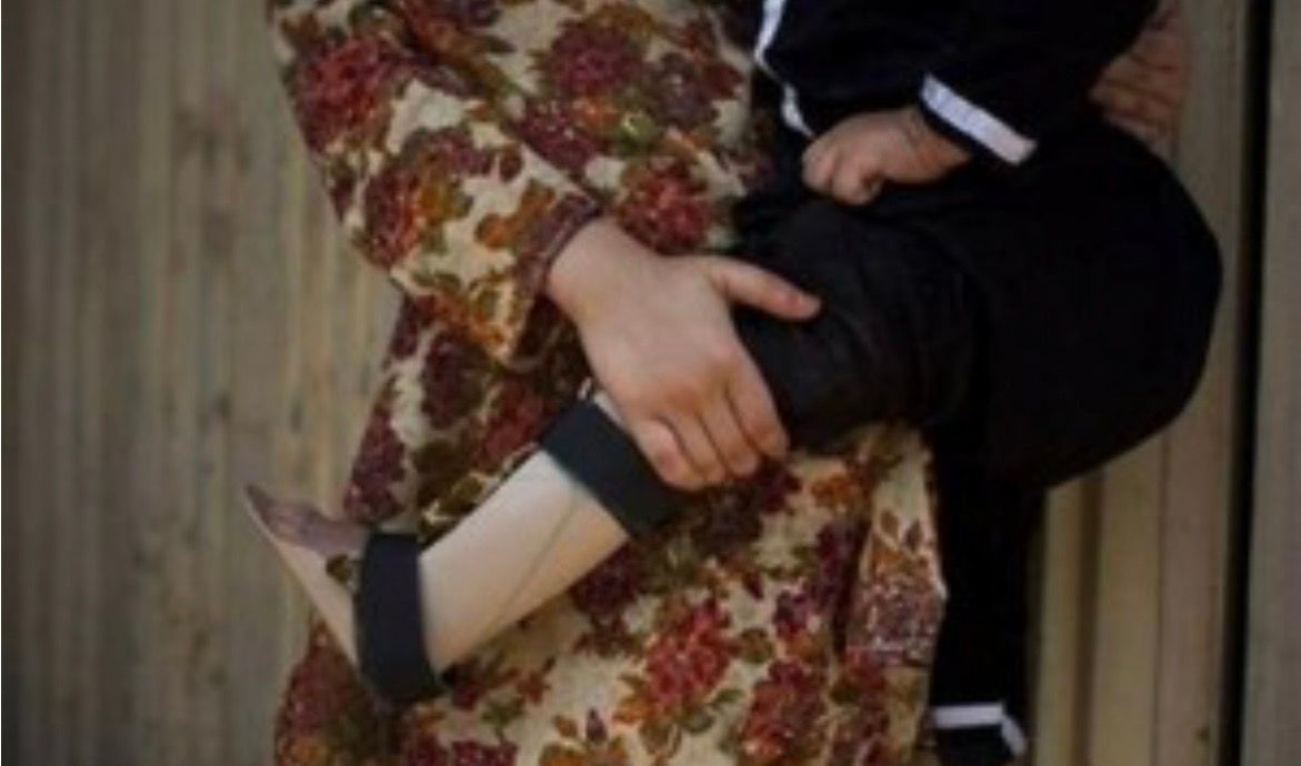 سومین مورد بیماری فلج کودکان در پاکستان ثبت شد