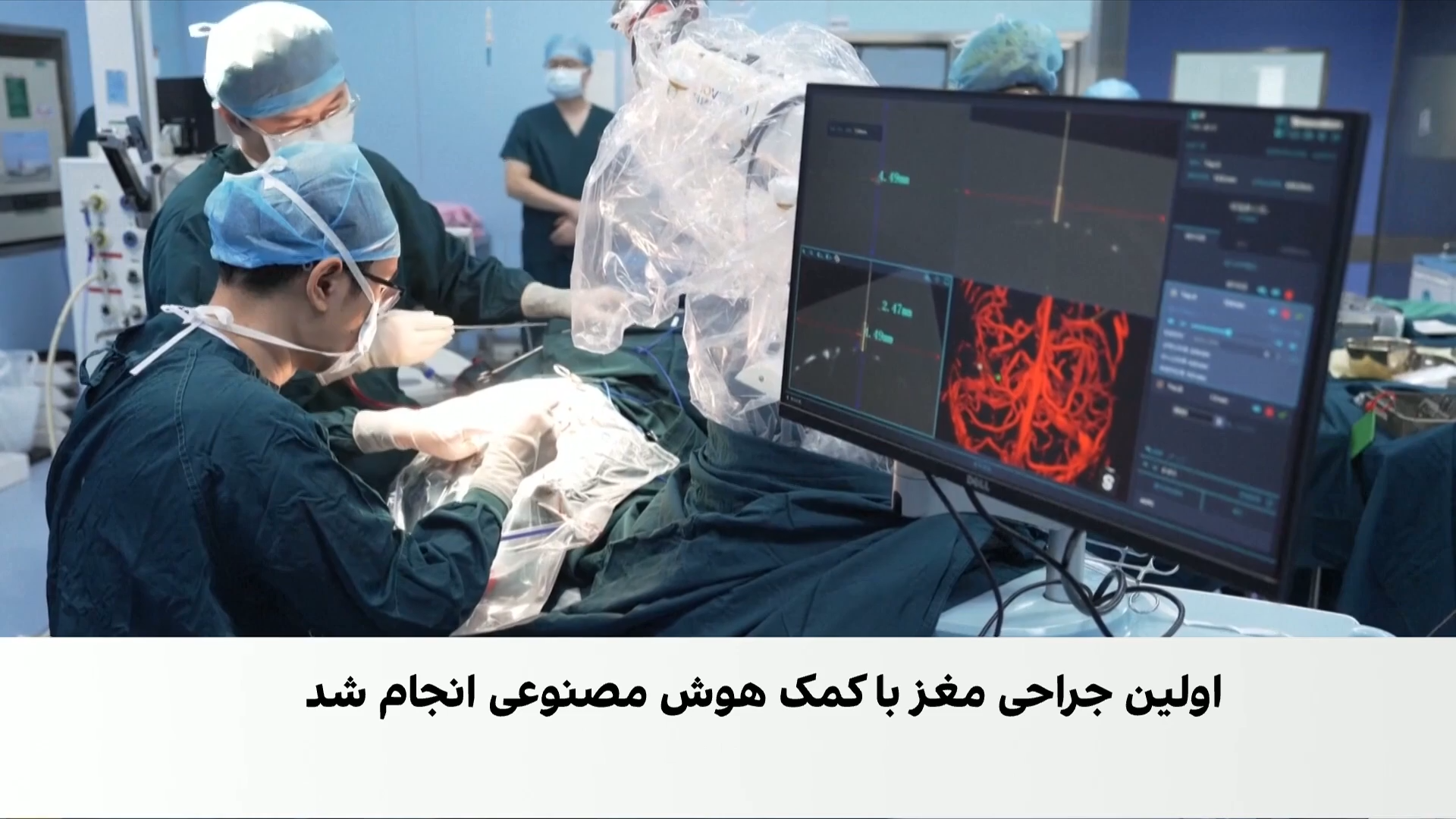 هوش مصنوعی وارد اتاق جراحی مغز شد