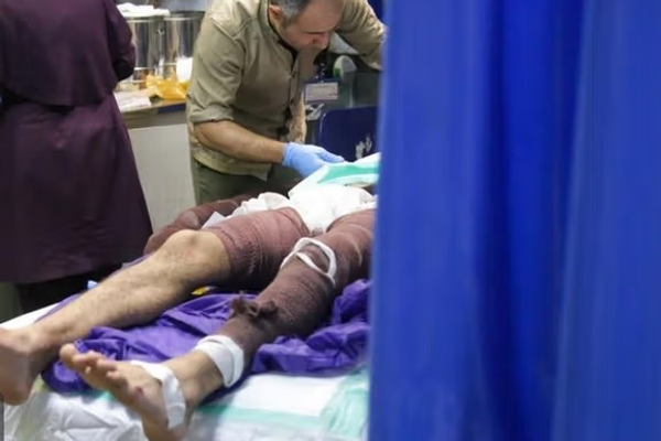 د ایران روغتیا وزارت: په دغه هېواد کې هرکال ۳زره کسان د سوځېدو له امله مري