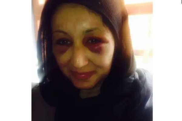 Afghan Female Intelligence Officer Reveals Torture in Taliban Prison