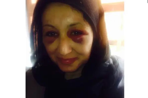 Afghan Female Intelligence Officer Reveals Torture in Taliban Prison