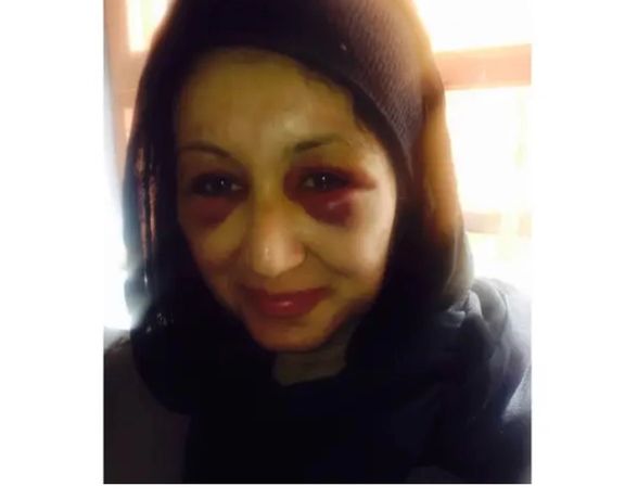 Afghan Female Intelligence Officer Reveals Torture in Taliban Prison