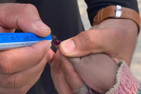 بدء حملة تطعيم شلل الأطفال في 17 ولاية أفغانية