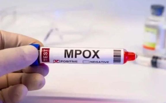 د پاکستان د روغتیا وزارت منلې چې د بیزو د تڼاکو یا چیچک ناروغۍ پېښې درېیو ته لوړې شوې دي