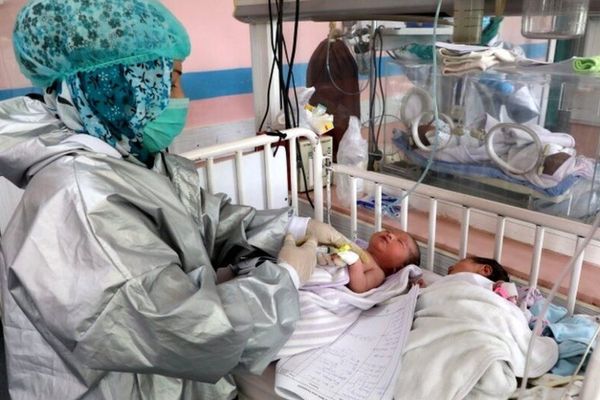 ملګري ملتونه: په افغانستان کې د ماشومانو سوء تغذي په بیساري کچه پراخه شوې