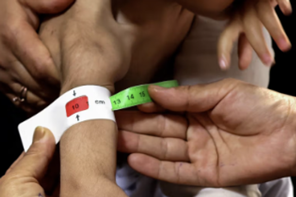 سكاي نيوز : طفل يموت كل 72 ساعة في مستشفى ولاية بدخشان