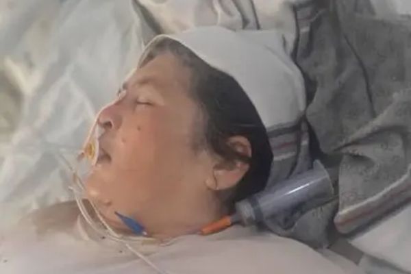 55-Year-Old Woman Allegedly Beaten by Taliban Police Commander in Takhar Dies