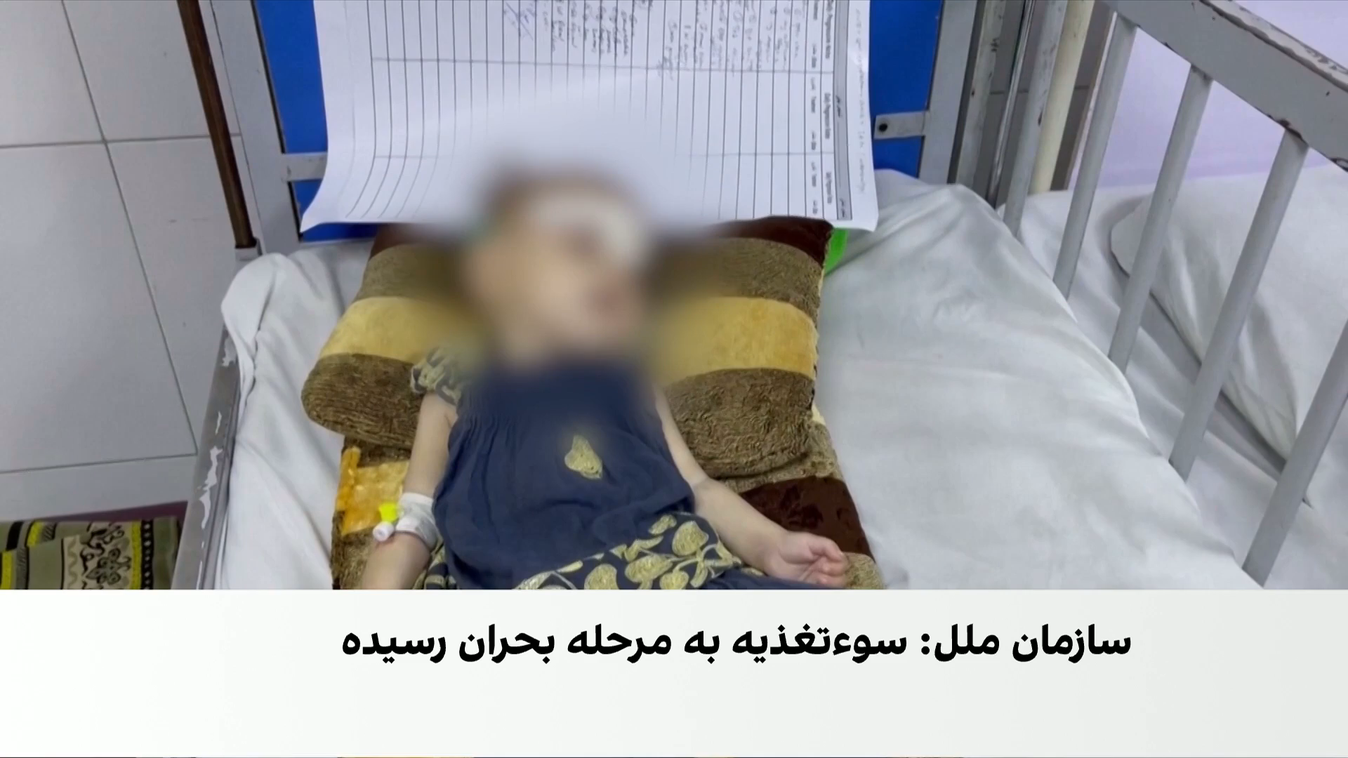 بحران سوءتغذیه در افغانستان عمیق‌تر شد
