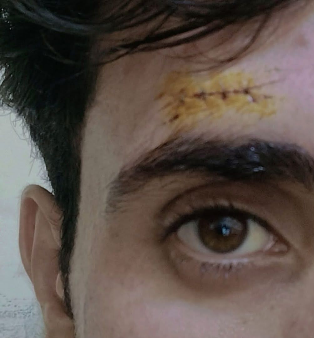 فقر او بې وزلي؛ په کابل او ولایتونو کې د وسله والو غلاوو زیاتوالي خلک اندېښمن کړي
