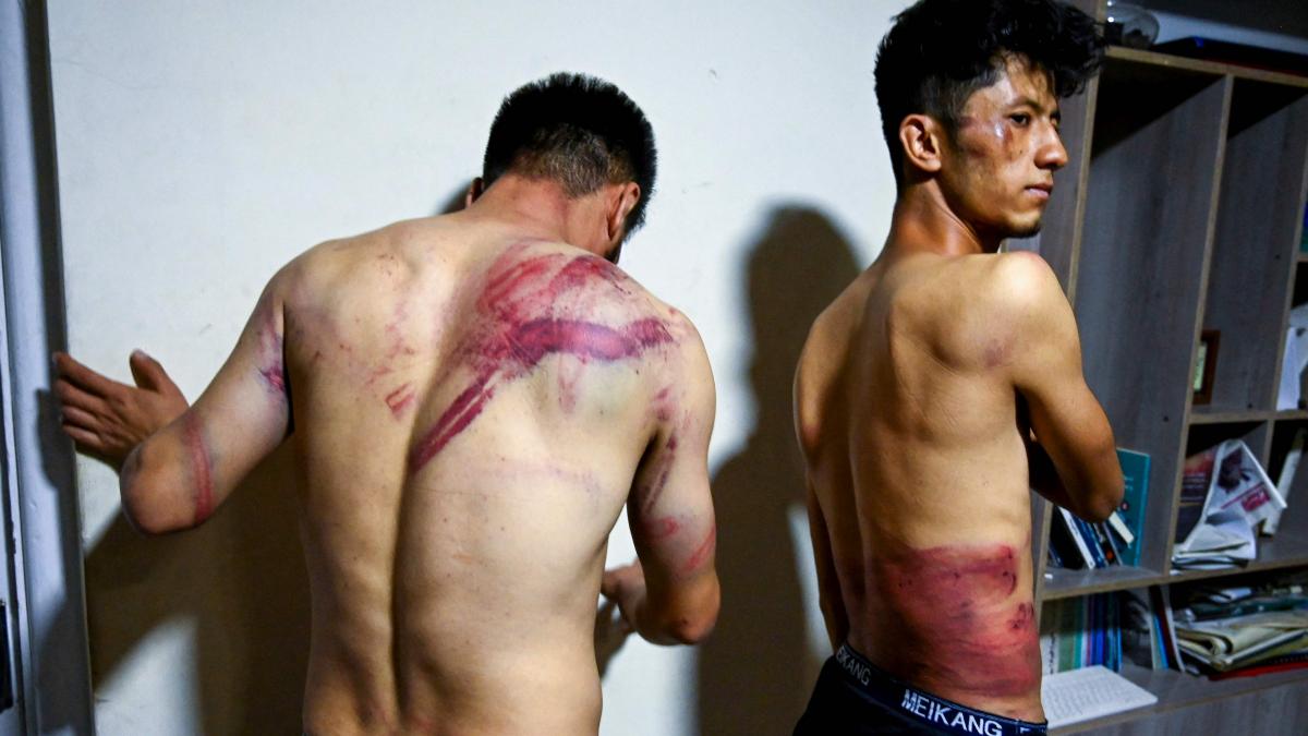 کمیته مصونیت خبرنگاران: در یک سال گذشته ۱۲ خبرنگار در افغانستان کشته شدند