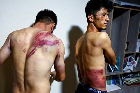 کمیته مصونیت خبرنگاران: در یک سال گذشته ۱۲ خبرنگار در افغانستان کشته شدند