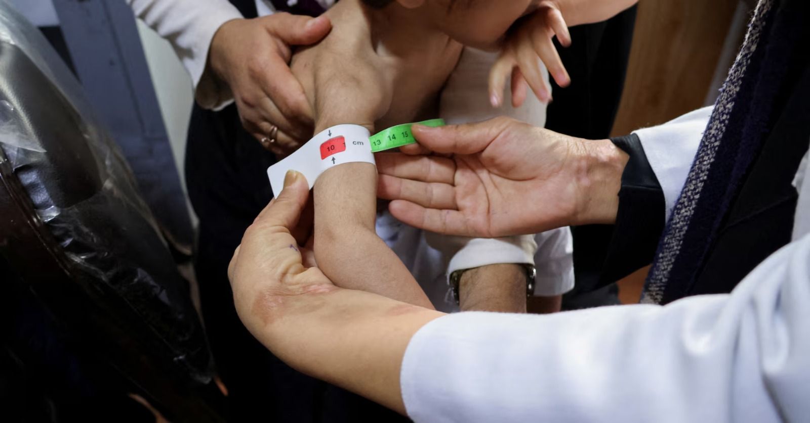 بحران سوءتغذیه؛ جان ۴ میلیون کودک در افغانستان در خطر است