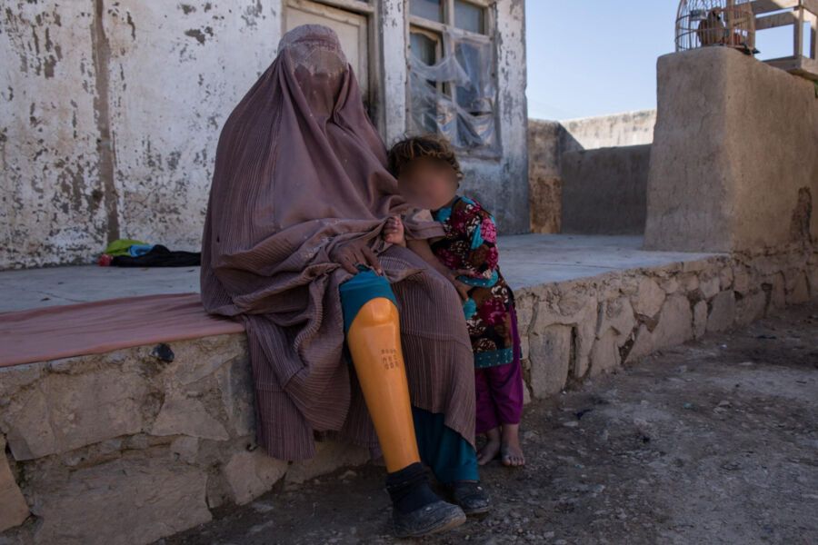 یوناما: په افغانستان کې د جګړو قربانیان لا هم له جسمي، رواني او اقتصادي ستونزو سره مخ دي