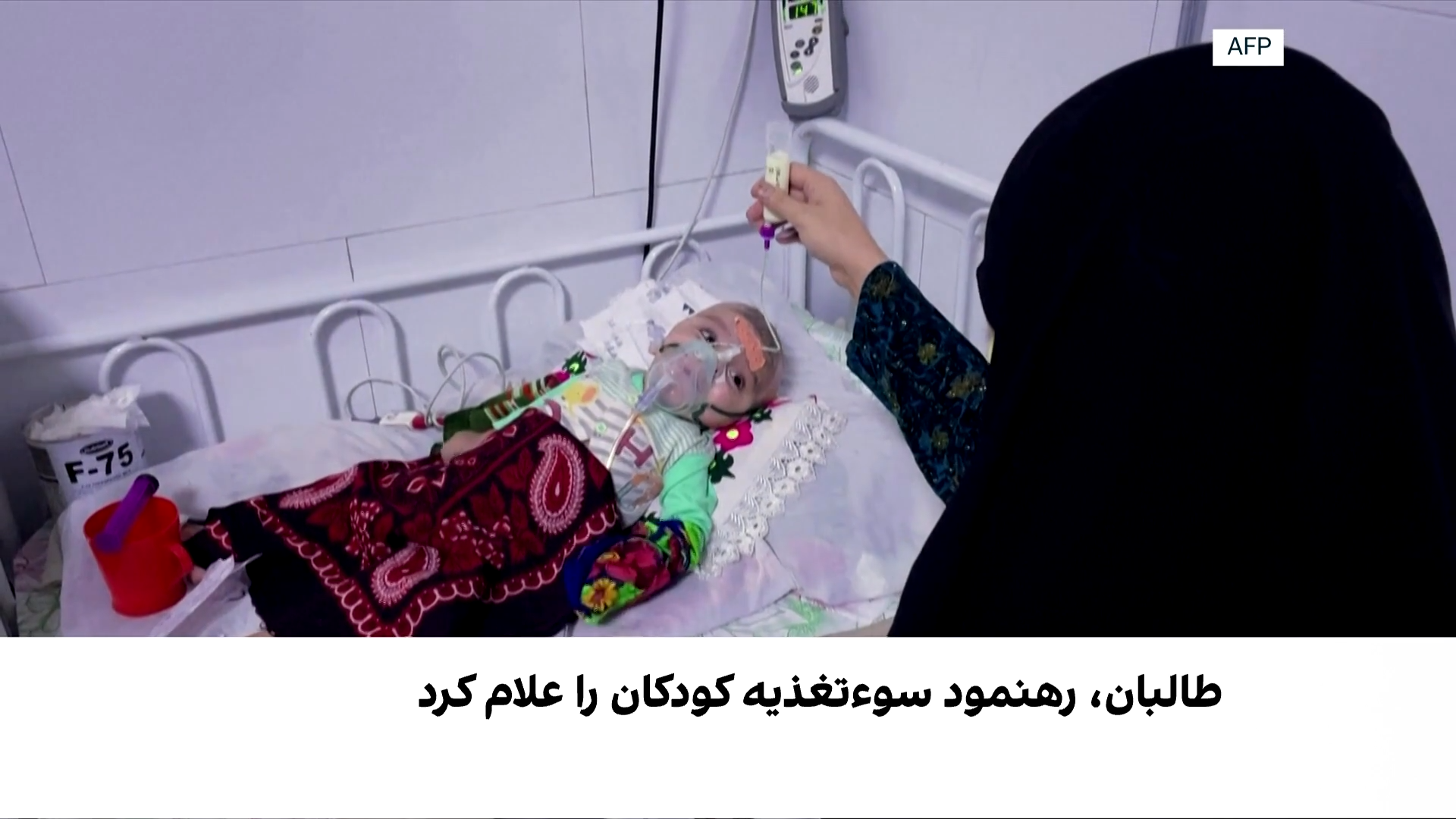 اعلام رهنمود ملی طالبان درباره سوءتغذیه کودکان