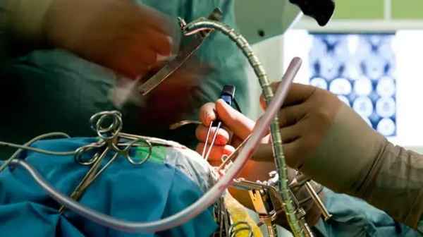 تحولی در جراحی تومورهای مغزی؛ استفاده از تراشه گرافنی برای شناسایی سلول‌های سرطانی