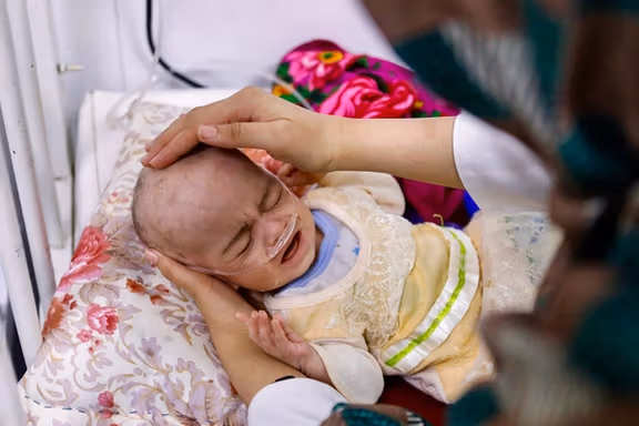 معاون دبیرکل سازمان ملل: صدها هزار کودک در افغانستان در خطر مرگ قرار دارند