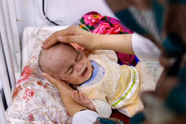 معاون دبیرکل سازمان ملل: صدها هزار کودک در افغانستان در خطر مرگ قرار دارند