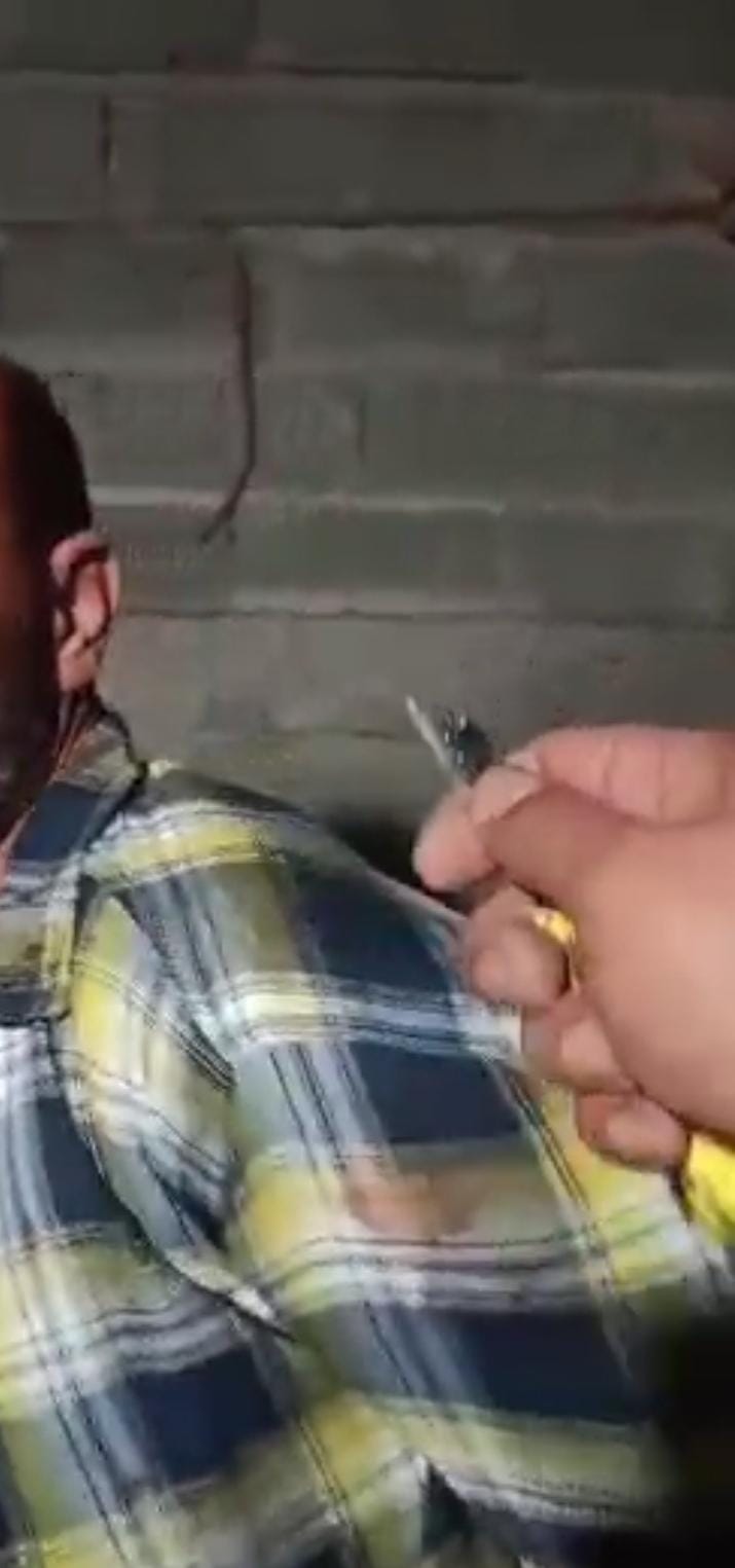 یک پناهجوی افغان در ایران برای گرفتن اعترافات اجباری شکنجه شده است