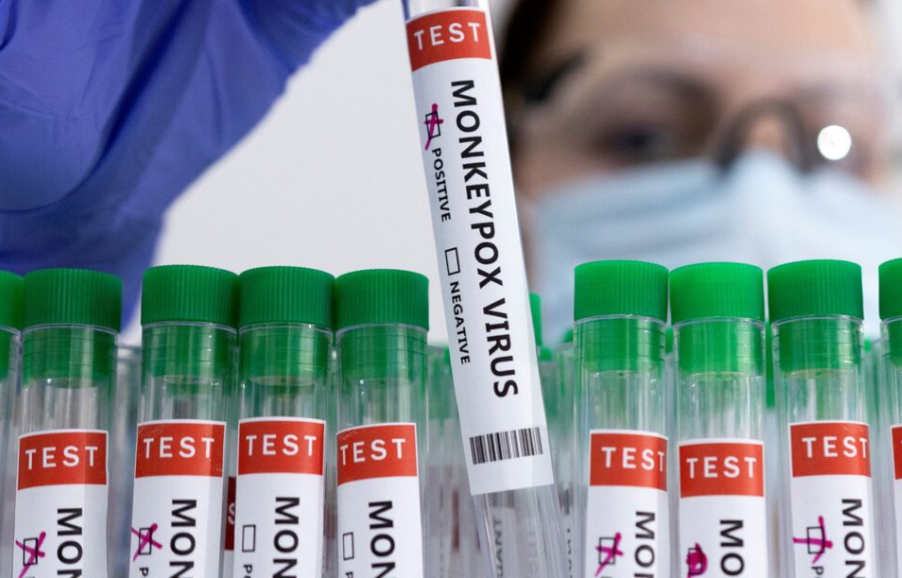 مقام‌های صحی پاکستان از شناسایی یک فرد مبتلا به ام‌پاکس در خیبرپختونخوا خبر دادند