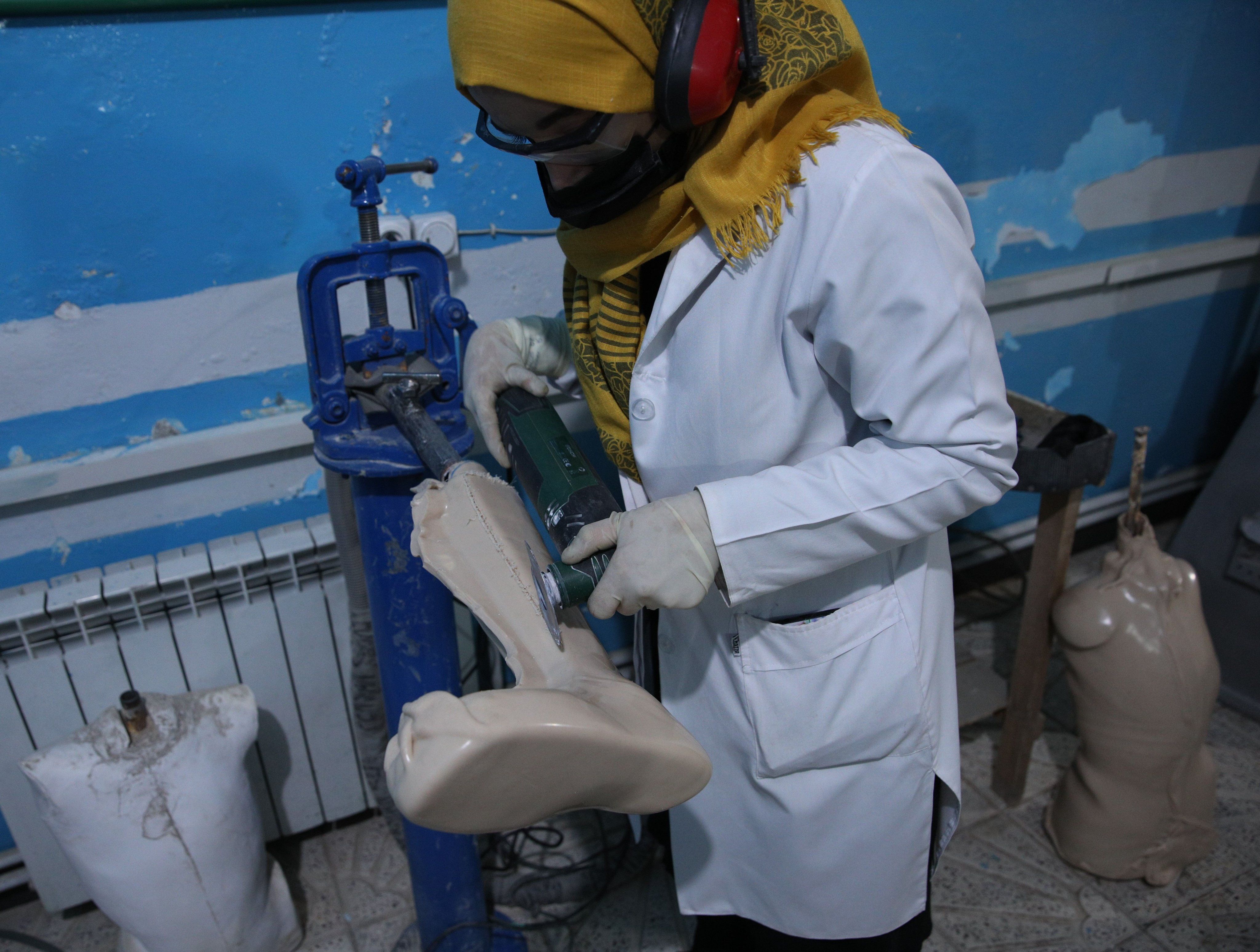 ملګري ملتونه وايي شاوخوا ۱،۵ میلیونه افغانان له جدي معلولیت سره ژوند کوي