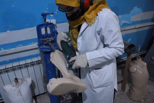 ملګري ملتونه وايي شاوخوا ۱،۵ میلیونه افغانان له جدي معلولیت سره ژوند کوي