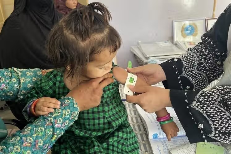 الأمم المتحدة: سوء التغذية بين الأطفال في أفغانستان بلغ مستوىً حرجاً