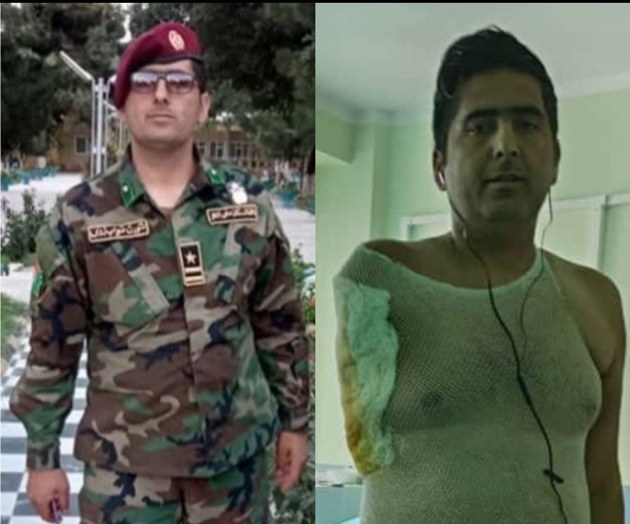 طالبان وايي په بېلاروس کې د شکنجه شوي پخواني افغان افسر ددرملنې لګښت یې پر غاړه اخېستی