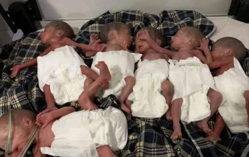 په جوزجان کې يوې مور شپږ ماشومان زېږولي 