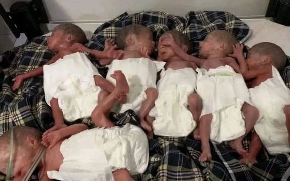 په جوزجان کې يوې مور شپږ ماشومان زېږولي