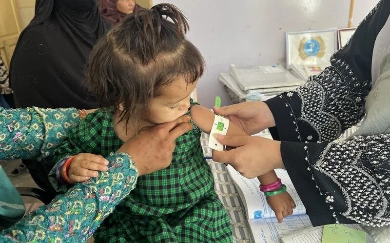 سازمان ملل: سوء‌تغذیه کودکان در افغانستان «به سطح بحرانی» رسیده است
