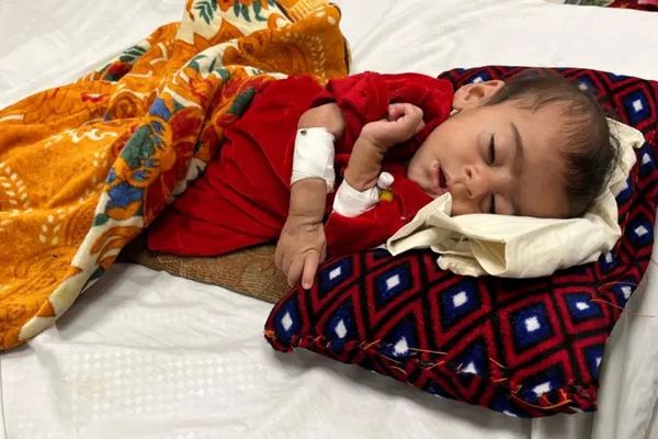 یونېسف: د ماشومانو او مېندو تر ټولو لوړه د خوارځواکۍ کچه په بدخشان کې ثبت شوې