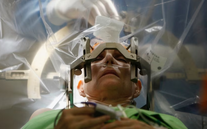 د ځیرکې د نصبولو عملیات