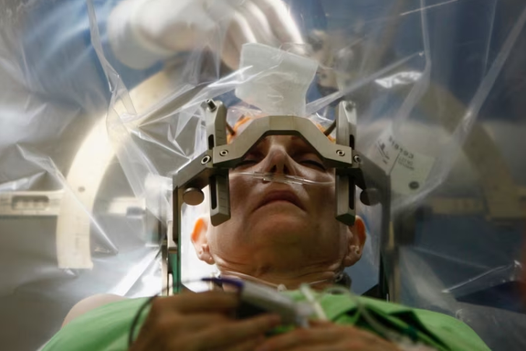 د ځیرکې د نصبولو عملیات