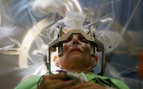 د ځیرکې د نصبولو عملیات