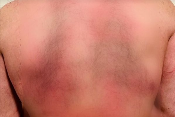 After University Lecturer Resigns to Protest Education Ban, Taliban Detains & Assaults Him