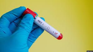 د زیړي نړۍواله ورځ؛ په افغانستان کې شاوخوا یو مېلیون کسان په زیړي اخته دي