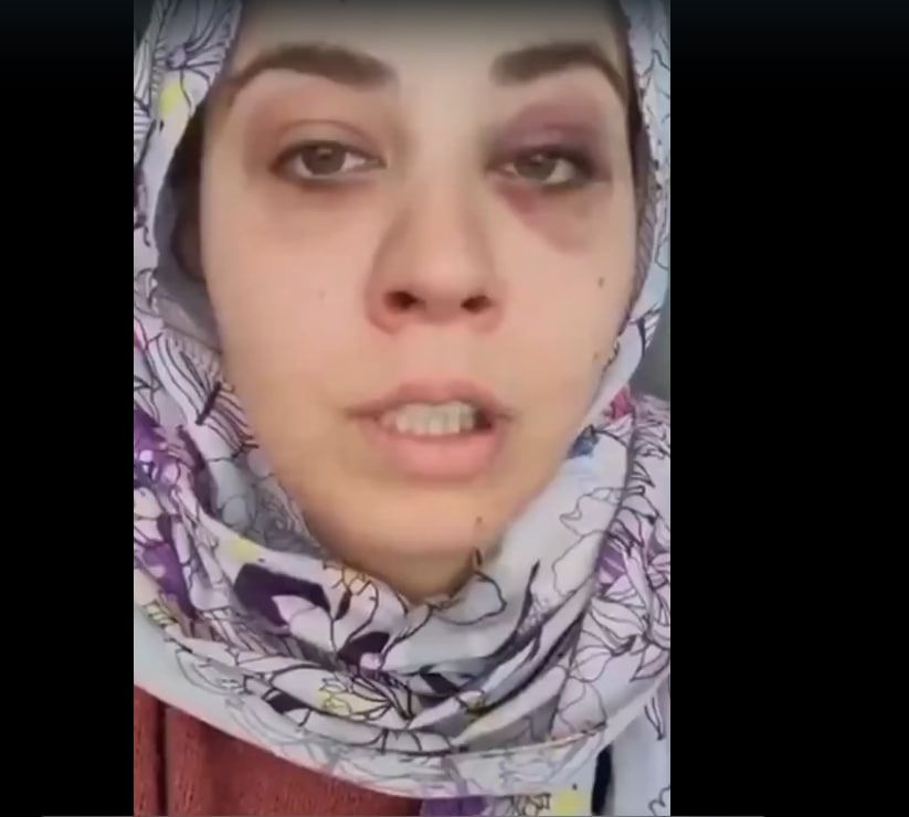 زن ترکیه‌ای در کابل پس از لت‌وکوب توسط همسر افغانش، خواستار کمک شد