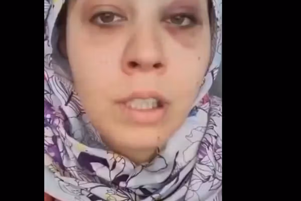 زن ترکیهای در کابل پس از لتوکوب توسط همسر افغانش، خواستار کمک شد