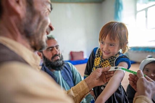 Malnourished Afghan Children Lack Access To Life-Saving Treatment