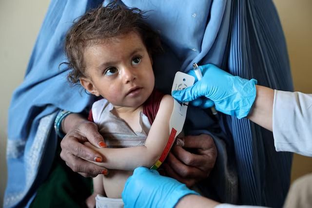 سازمان ملل: نزدیک به چهار میلیون کودک در افغانستان از سوء‌‌تغذیه رنج می‌برند