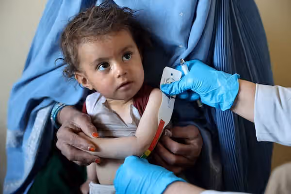 سازمان ملل: نزدیک به چهار میلیون کودک در افغانستان از سوءتغذیه رنج میبرند
