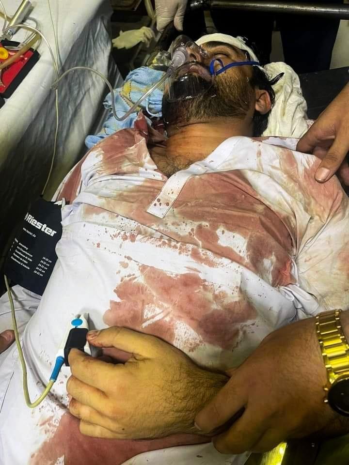 د پښتون ژغورنې غورځنګ غړی ګیله من وزیر ناپېژاندو وسله والو په چاقوګانو وهلی دی