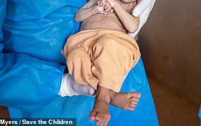 دیلی میل: یک سال بعد از تسلط طالبان در افغانستان، نوزادان از گرسنگی میمیرند