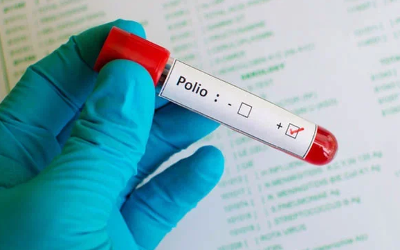 پاکستاني رسنۍ: پاکستان کې د پولیو ناروغۍ نهه مثبتې پېښې ثبت شوې دي
