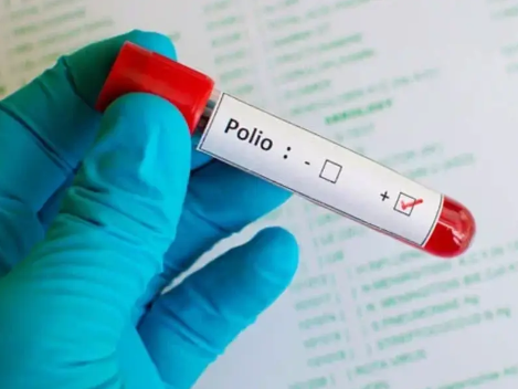 د پاکستان په چکوال کې د پولیو له نوې پېښې سره په دغه هېواد کې د پولیو ۱۲مه پېښه ثبت شوه