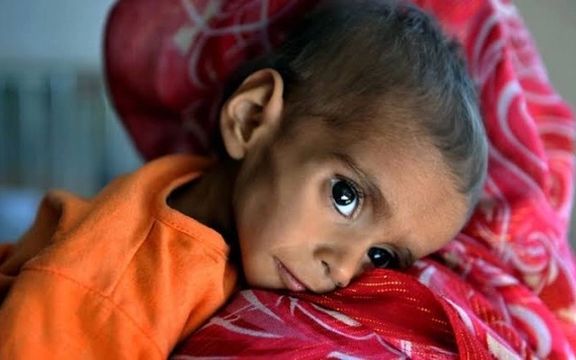 د ماشومانو د ژغورنې صندوق: په افغانستان کې ماشومان تر نورو زیات له لوږې او خوارځواکۍ کړیږي