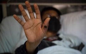 په خیبرپښتونخوا کې چارواکي: د بیزو د تڼاکو یا چیچک تازه دوه پېښې ثبتې شوې