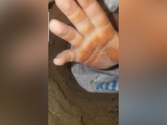 پایان عملیات ناموفق در زابل؛ حیدر، کودک شش ساله جان باخت